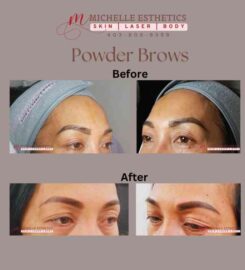 Michelle Esthetics Skin Laser Body