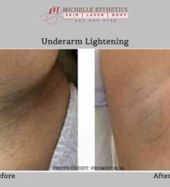 Michelle Esthetics Skin Laser Body